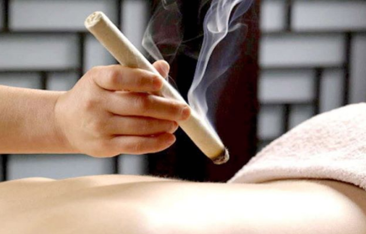 Cứu điều trị hội chứng thắt lưng hông (Tọa cốt phong; Yêu cước thống)